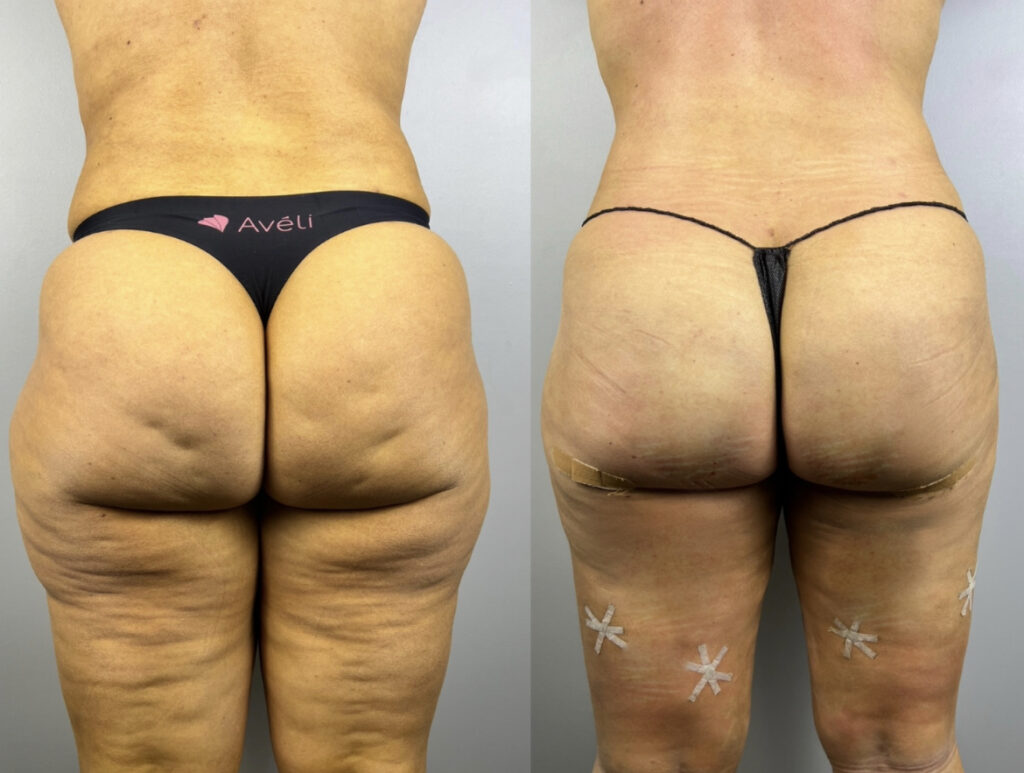 Patients, Before and After Treatment Picture