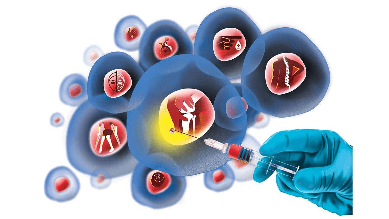 Stem cells in regenerative medicine