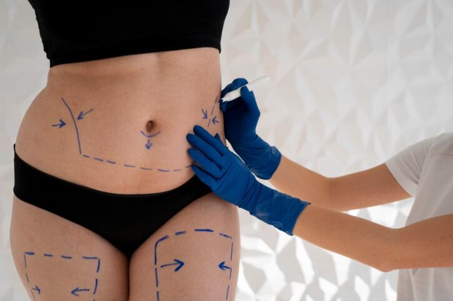 Power Assisted Liposuction